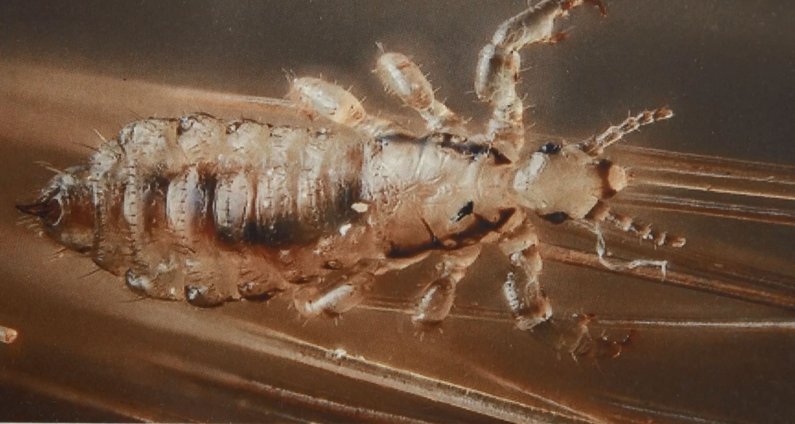 'Super lice' resistant to over the counter treatments WNEM TV 5